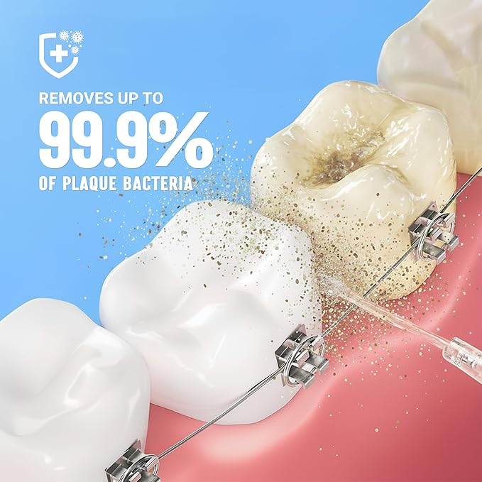 Portable Water Flosser for Teeth - 4 Modes Cordless Oral Irrigator with 300ML Tank 360° Rotating Nozzle 4 Jet Tips Rechargeable IPX7 Waterproof Low Noise Gravity Ball Design (M159 - White)