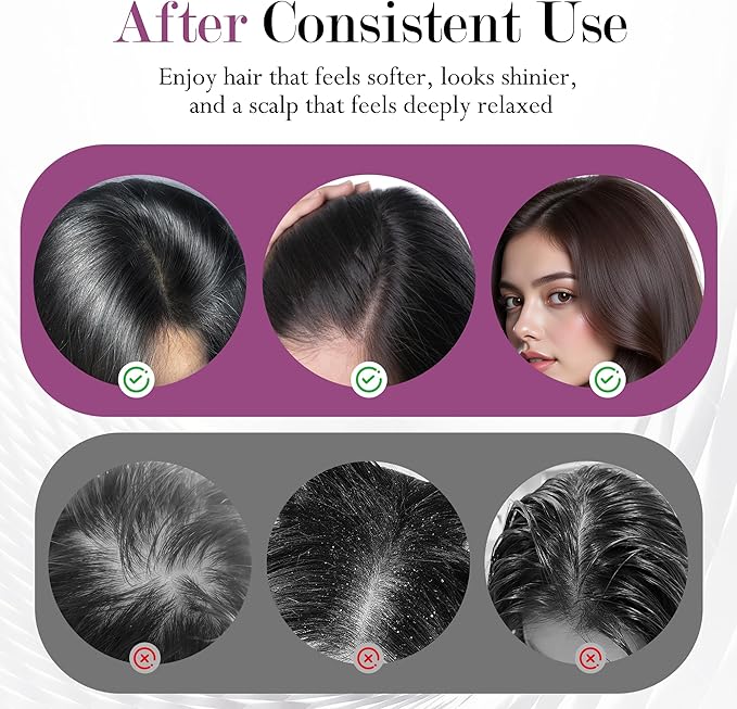 3-in-1 Rechargeable Scalp Massager Hair Growth Oil Applicator Gentle Scratching &amp Kneading IPX7 Waterproof Electric Head Massage Tool for Home Spa Portable Scalp Brush for All Hair Types