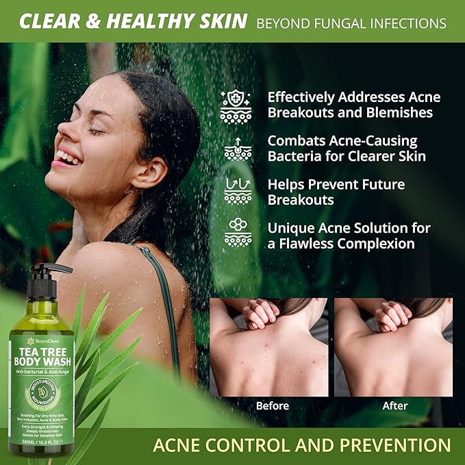 Roycederm Tea Tree Antifungal Care Bundle: Body Wash &amp Shampoo for Skin and Scalp Health