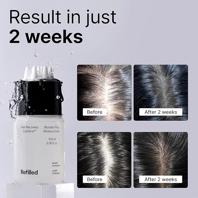 REFILLED Booster Plus Moisture | Hair Growth Serum &amp Thickening Scalp Treatment with Built-in Massager for Men &amp Women | Hair Loss &amp Thinning | Fuller &amp Baby Hair Regrowth | Fast-Absor