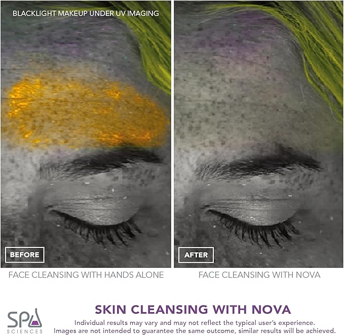 Spa Sciences - NOVA - Sonic Cleansing Brush with Bristles &amp Infusion System – Anti-Aging Facial Exfoliating Waterproof and USB Rechargeable