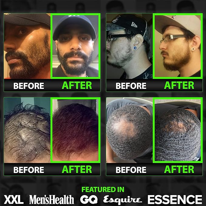 Beard Growth Kit w/ 2X Biotin Beard Balm for Men &amp Mustache Wax + GROW 11-in-1 Mens Shampoo &amp Conditioner (Hair Growth Shampoo for Men w/Biotin) + GROW Facial Hair Growth Oil (Made in America)