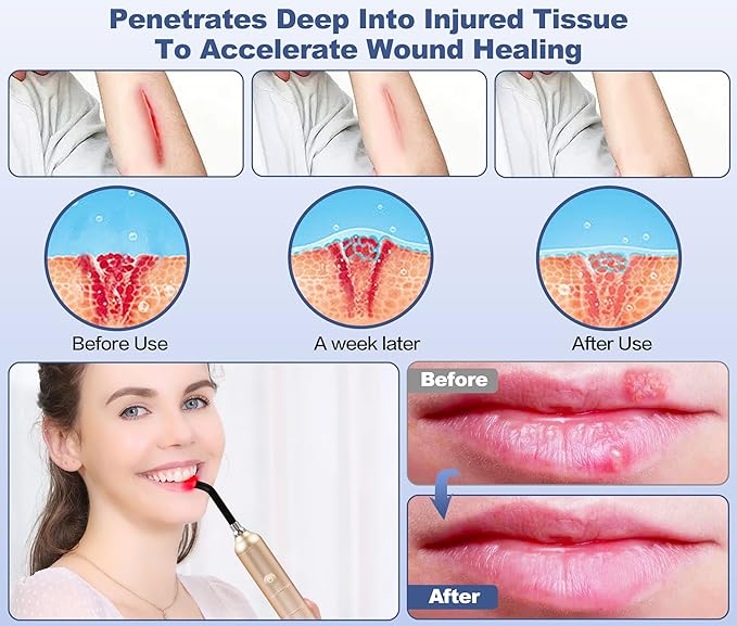 Red Light Therapy for Body &amp Face Inflammation with Dual 660nm Portable Near Infrared Light Therapy for Joints &amp Muscles Pain Relief with 810nm 850nm 940nm Effective 2 in 1 Modes Design as