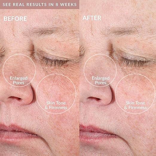 Clean Pro OB - Smart Facial Cleansing Device