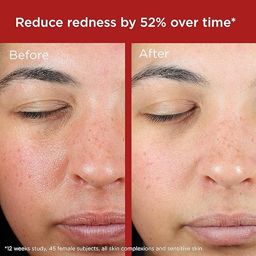 EltaMD UV Skin Recovery Face Sunscreen with Zinc Oxide All Mineral Safe for Sensitive Skin SPF 50