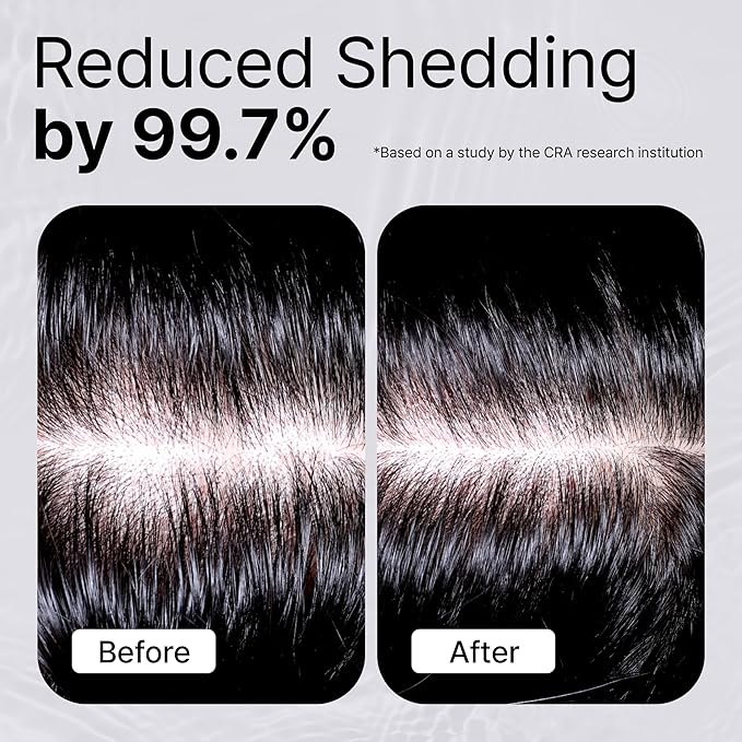 REFILLED Booster Plus Moisture | Hair Growth Serum &amp Thickening Scalp Treatment with Built-in Massager for Men &amp Women | Hair Loss &amp Thinning | Fuller &amp Baby Hair Regrowth | Fast-Absor