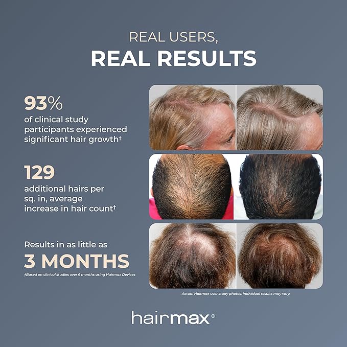 Hairmax Ultima 9 Classic LaserComb -(FDA Cleared) Laser Hair Regrowth Treatment Device for Men &amp Women - Reverses Thinning Hair Loss - Red Light Therapy to Stimulate Hair Growth - Cordless Design