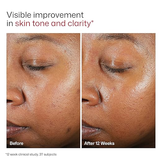 EltaMD UV Clear Tinted Face Sunscreen SPF 46 Oil Free Sunscreen for Sensitive Skin with Zinc Oxide Dermatologist Recommended